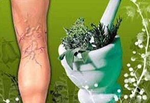 gyógynövények a varikózis kezelésére