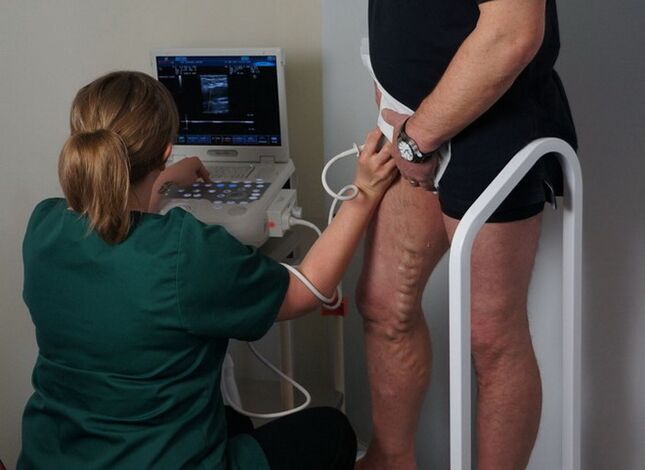 vénák vizsgálata visszerek lézeres koagulációja előtt